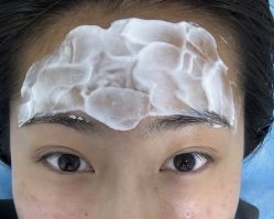 -天津健丽·去眼袋医疗美容机构