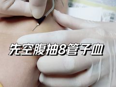 -爱康国宾体检中心(五角场万达广场分院)