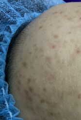 -蕾特恩专业祛痘·皮肤管理