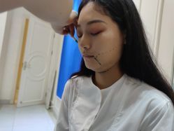 -欧扬医疗美容