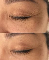 -比华利美容医院