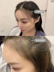 -Rise Hair上升造型