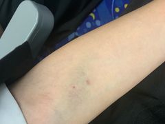-悦检(珠江医院体检中心)