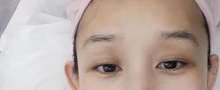 -天津健丽·去眼袋医疗美容机构