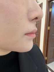 -长沙雅美医疗美容医院