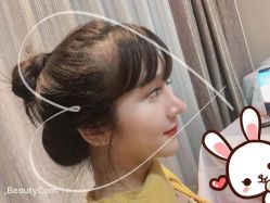 -大麦微针植发丨全国连锁