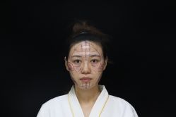 点击看大图 -禾美嘉医疗美容