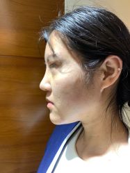 -伊美尔医疗美容医院