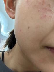 -广州美莱医疗美容医院