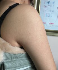 -广州美莱医疗美容医院