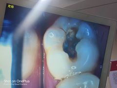 -同步齿科·数字化正畸种植口腔中心(前山店)