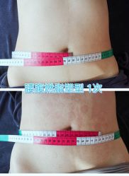 点击看大图 -纤思韵产后修复健康管理中心(顺义金街店)