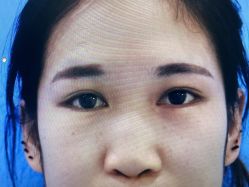 -西安壹加壹医疗美容·西北抗衰旗舰店