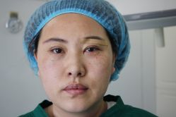 -天津健丽·去眼袋医疗美容机构