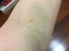 -广州仁爱天河医院体检中心