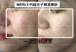 -MLP美丽派·问题肌疗愈中心