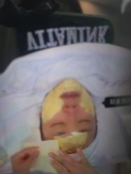 -SKIN79皮肤管理中心