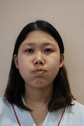 -北京米扬丽格医疗美容·联合丽格鼻整形中心