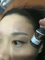 -郡艺医疗美容·微整·眼鼻吸脂