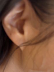 -美瑞莎创美医疗美容