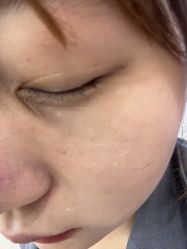 -长沙雅美医疗美容医院