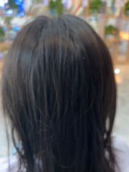 -碧莲盛·不剃发植发