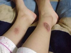 iphone_upload_pic-莱蔻·圣灸堂·推拿艾灸(天山店)