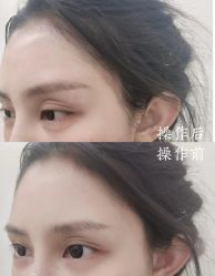 -西施无菌半永久纹绣眉眼影唇轻增发纹发际线