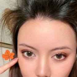 -碧莲盛·不剃发植发