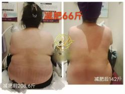 -丽减美瘦吧·减肥瘦身