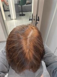 -GANO HAIR 