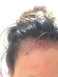 -雍禾植发全国连锁