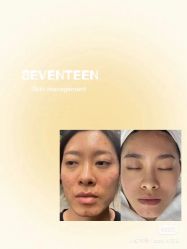 -苗方清颜痘肌研究所