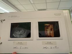 -杭州贝瑞斯美华妇儿医院·早孕·产检·儿科