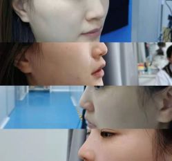 -洁铭新加坡医美