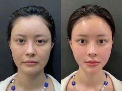 -LUNA皮相美·骨相美高级美感