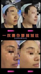 -安吉拉青春化管理中心