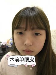 -素美医疗美容·西南眼鼻整形·修复基地