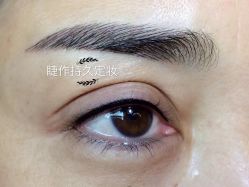 点击看大图 线条眉➕美瞳线遮盖陈旧性眼线-光SPA科技美肤