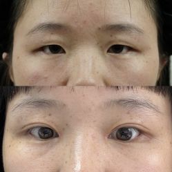 -素美医疗美容·西南眼鼻整形·修复基地