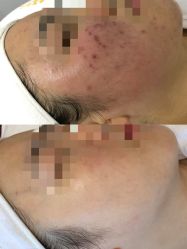 -康美贞·痘肌养护管理中心