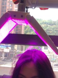 -碧莲盛·不剃发植发