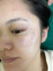 体验后-北京八大处第二医疗美容医院