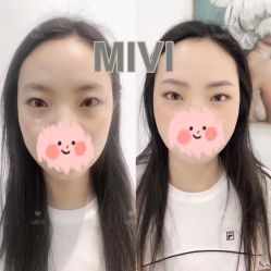 -MIVI半永久纹眉纹绣