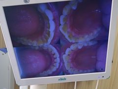 -爱牙联合口腔(门诊报销 海云庵店)