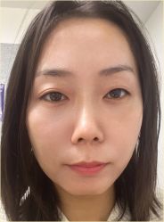 体验后-联合丽格·张菡丽格医疗美容