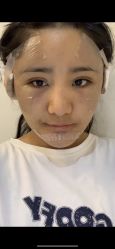 体验前-禾美嘉医疗美容