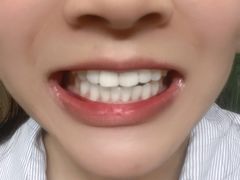 -美酷口腔牙齿矫正(江桥万达店)
