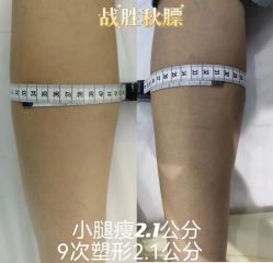 -Lily纤美·科技减脂中心