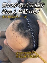 -雍禾植发全国连锁